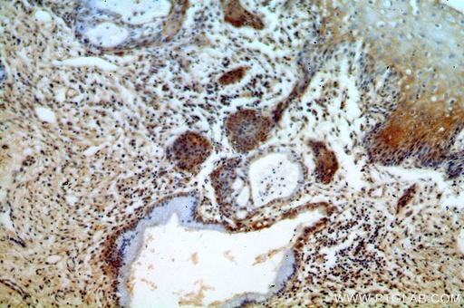 [14007-1-AP-150UL] ESR2 Polyclonal antibody