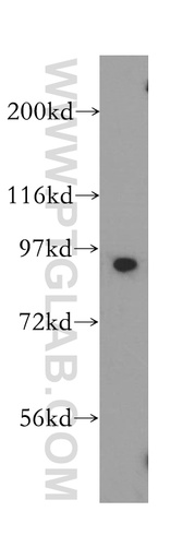 [14010-1-AP-150UL] SOX6 Polyclonal antibody