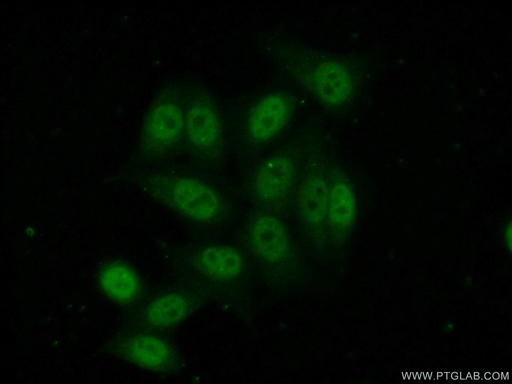 [14014-1-AP-150UL] NFKBIZ Polyclonal antibody