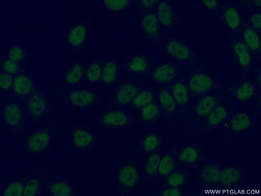 [14015-1-AP-20UL] STAG1 Polyclonal antibody