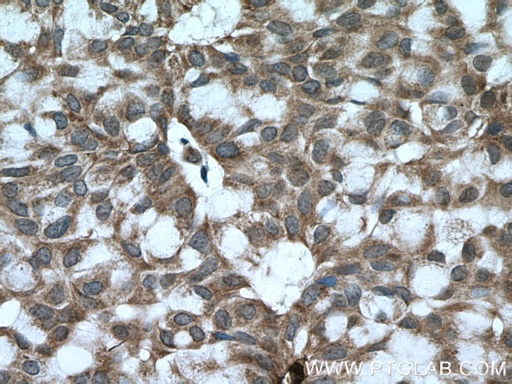 [14018-1-AP-150UL] BACH1 Polyclonal antibody