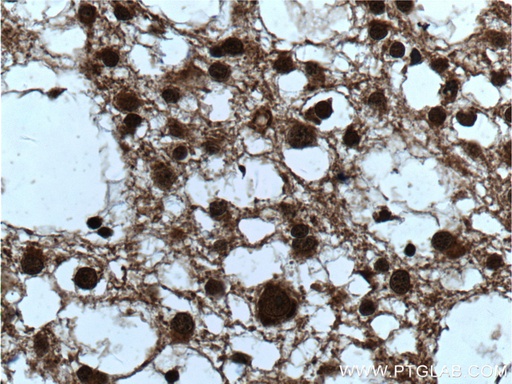 [14026-1-AP-150UL] ZEB2 Polyclonal antibody