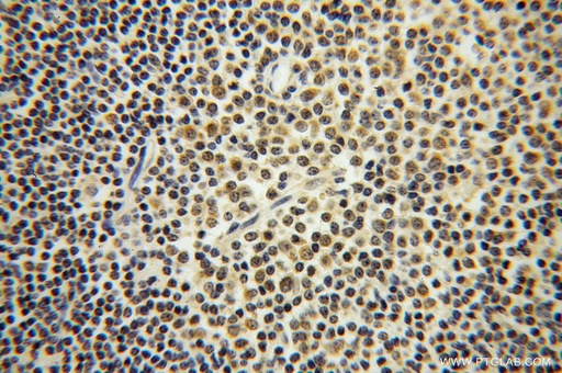 [14027-1-AP-20UL] ROD1 Polyclonal antibody