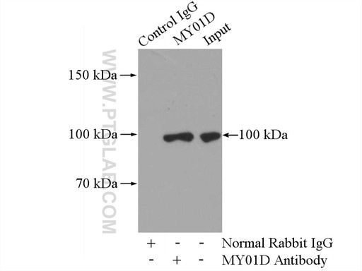 [14028-1-AP-150UL] MYO1D Polyclonal antibody