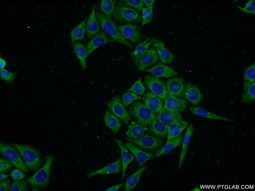 [14040-1-AP-20UL] ACRV1 Polyclonal antibody