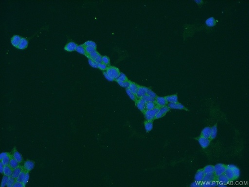 [14046-1-AP-150UL] HLCS Polyclonal antibody