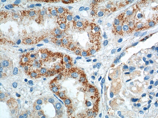 [14047-1-AP-150UL] GPR116 Polyclonal antibody