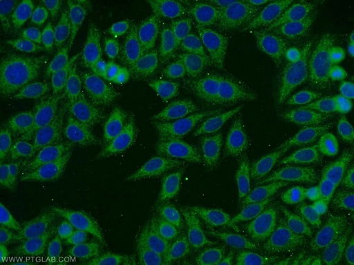 [14048-1-AP-20UL] FATP2 Polyclonal antibody
