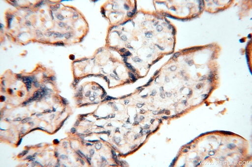[14049-1-AP-150UL] MAN1A2 Polyclonal antibody