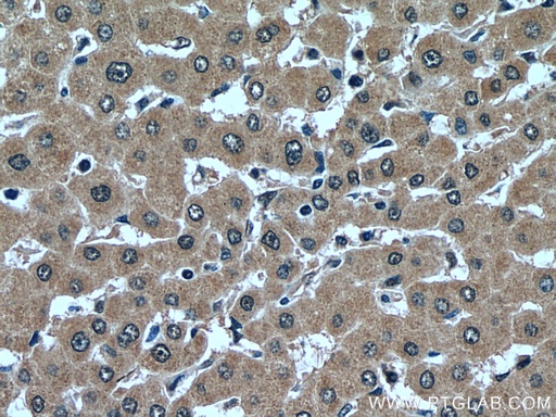 [14055-1-AP-20UL] USP16 Polyclonal antibody
