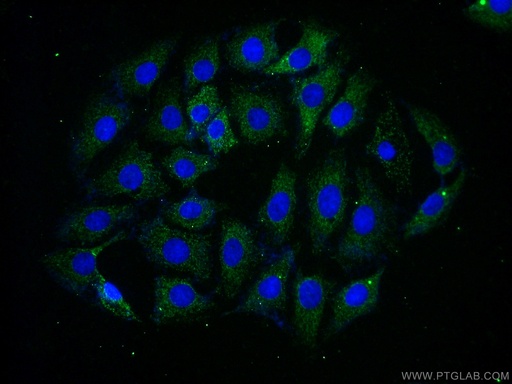[14056-1-AP-20UL] RGS7 Polyclonal antibody