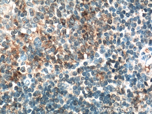 [14057-1-AP-20UL] CD200 Polyclonal antibody