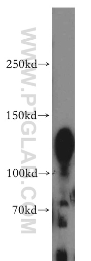 [14062-1-AP-150UL] PKP4 Polyclonal antibody