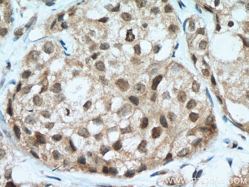 [14063-1-AP-150UL] SETD8 Polyclonal antibody