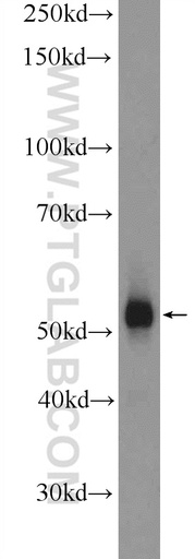 [14065-1-AP-150UL] DAZ4 Polyclonal antibody