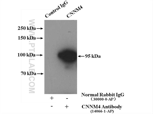 [14066-1-AP-150UL] CNNM4 Polyclonal antibody
