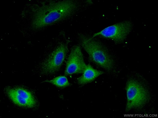 [14067-1-AP-20UL] CCP1 Polyclonal antibody