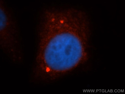 [14068-1-AP-150UL] ARID3A Polyclonal antibody