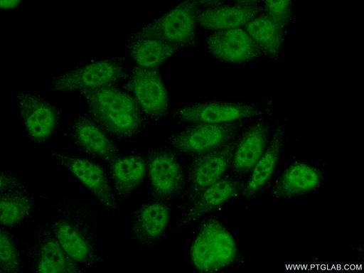 [14069-1-AP-20UL] INTS5 Polyclonal antibody