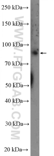 [14070-1-AP-150UL] L3MBTL3 Polyclonal antibody