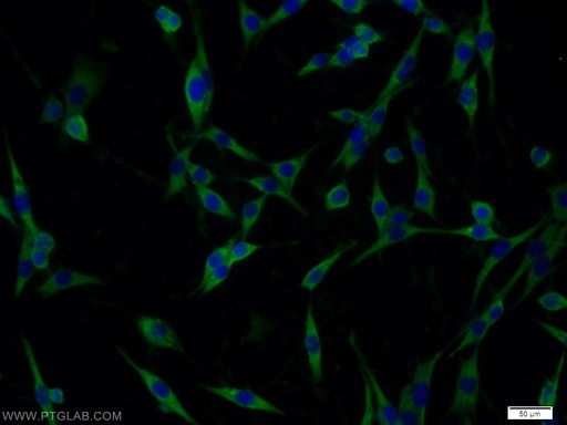 [14071-1-AP-150UL] Nicastrin Polyclonal antibody