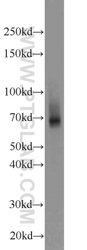 [14072-1-AP-150UL] ZNF354A Polyclonal antibody