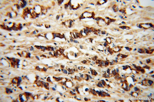 [14075-1-AP-20UL] PDGFD Polyclonal antibody