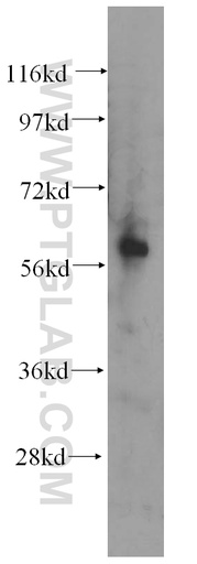 [14076-1-AP-20UL] AMIGO2 Polyclonal antibody