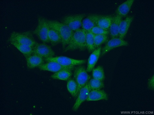 [14077-1-AP-20UL] UBE2R2 Polyclonal antibody