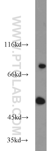 [14079-1-AP-20UL] Kv1.3 Polyclonal antibody