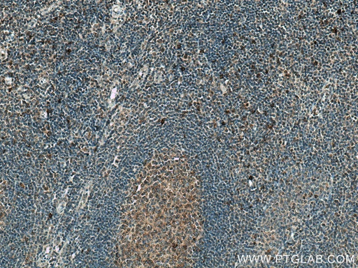 [14085-1-AP-150UL] NINJ2 Polyclonal antibody