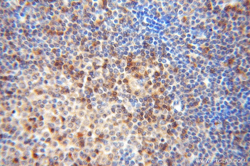 [14087-1-AP-20UL] DOK2 Polyclonal antibody