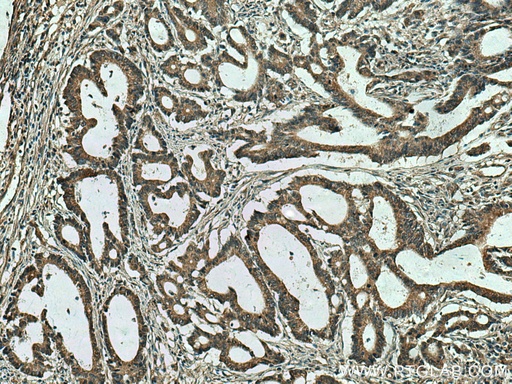 [14089-1-AP-20UL] SLC5A11 Polyclonal antibody