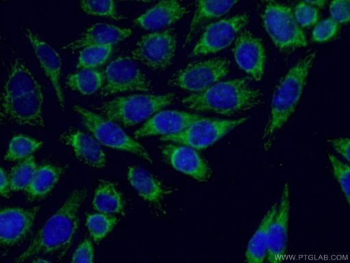 [14092-1-AP-150UL] ARHGEF7 Polyclonal antibody