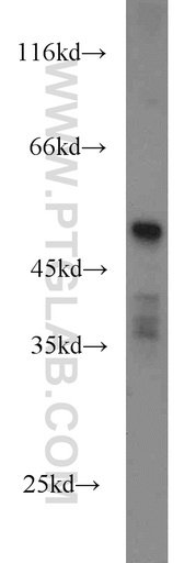 [14095-1-AP-150UL] HTRA4 Polyclonal antibody