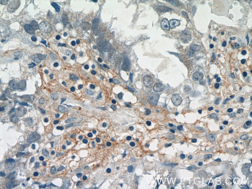 [14101-1-AP-150UL] PRR13 Polyclonal antibody