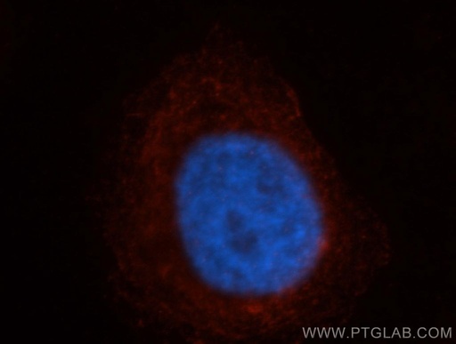[14106-1-AP-20UL] NAPB Polyclonal antibody