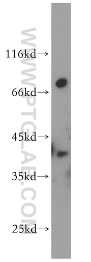 [14108-1-AP-150UL] DOK6 Polyclonal antibody