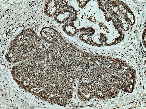 [14109-1-AP-150UL] SEPHS2 Polyclonal antibody