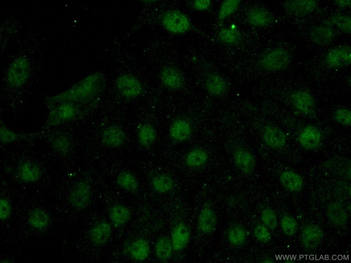[14111-1-AP-20UL] FOXR2 Polyclonal antibody