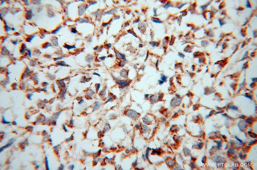 [14114-1-AP-150UL] ATP5J Polyclonal antibody