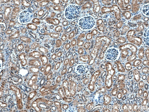 [14116-1-AP-20UL] ASPH Polyclonal antibody