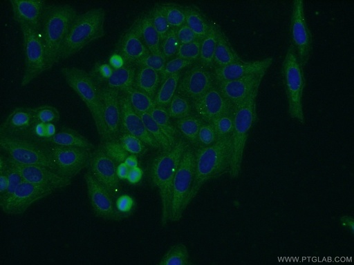[14118-1-AP-20UL] FADS Polyclonal antibody