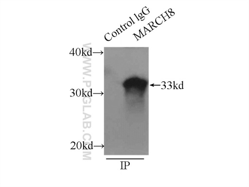 [14119-1-AP-150UL] MARCH8 Polyclonal antibody