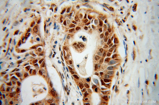 [14121-1-AP-20UL] RPL17 Polyclonal antibody