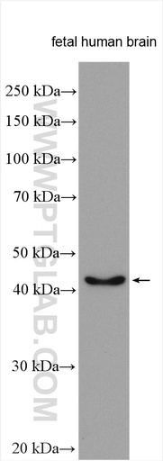 [14124-1-AP-150UL] MARCKSL1 Polyclonal antibody