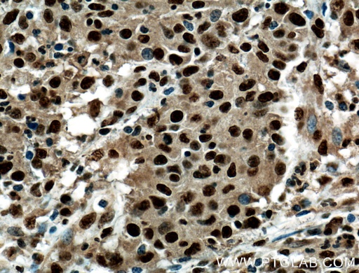 [14126-1-AP-20UL] PRDM5 Polyclonal antibody