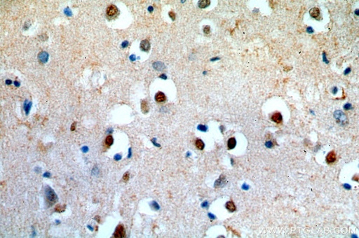 [14129-1-AP-20UL] APC4 Polyclonal antibody