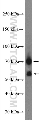 [14131-1-AP-150UL] CHST15 Polyclonal antibody