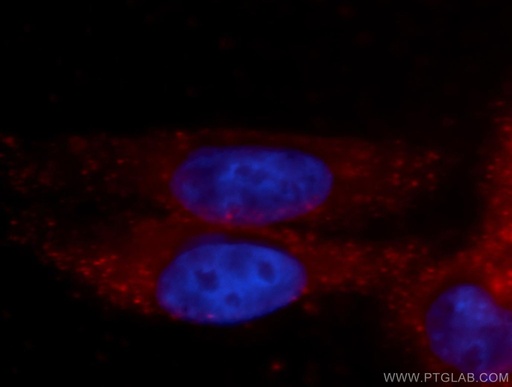 [14132-1-AP-150UL] GFPT1 Polyclonal antibody